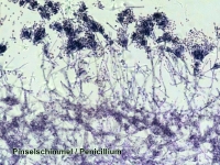 nabir-mikropreparativ-bresser-100-sht-5986003-11569-fotofox.com.ua-2.jpg